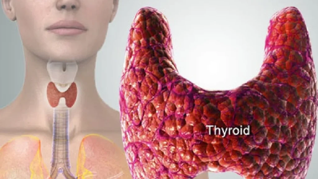 Thyroid Malfunction