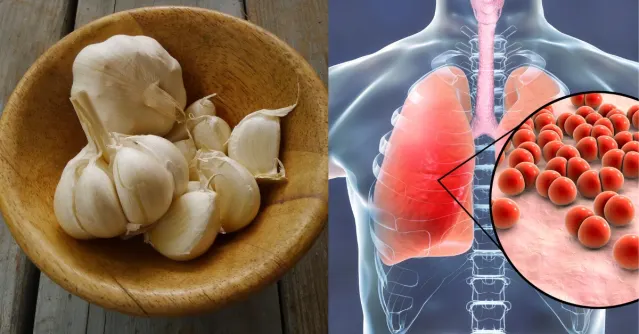 Garlic for Infections